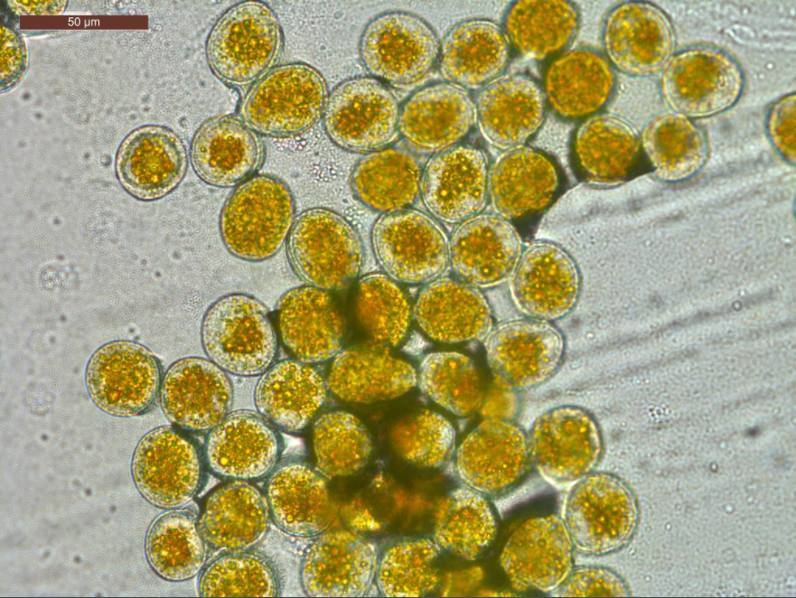 Urediniospores